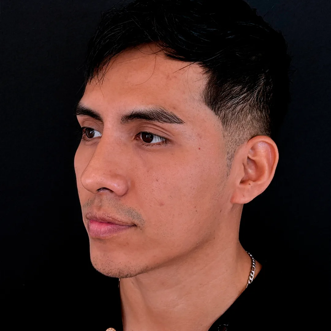 fm_web-rino-max-posado