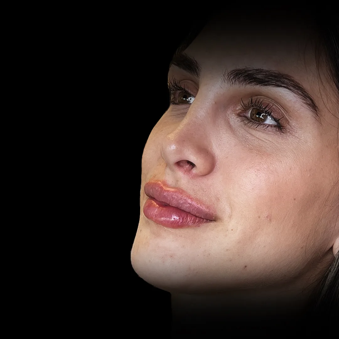 FM_relleno de labios-web